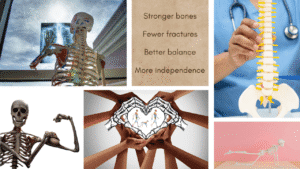 The power of a team approach to osteoporosis